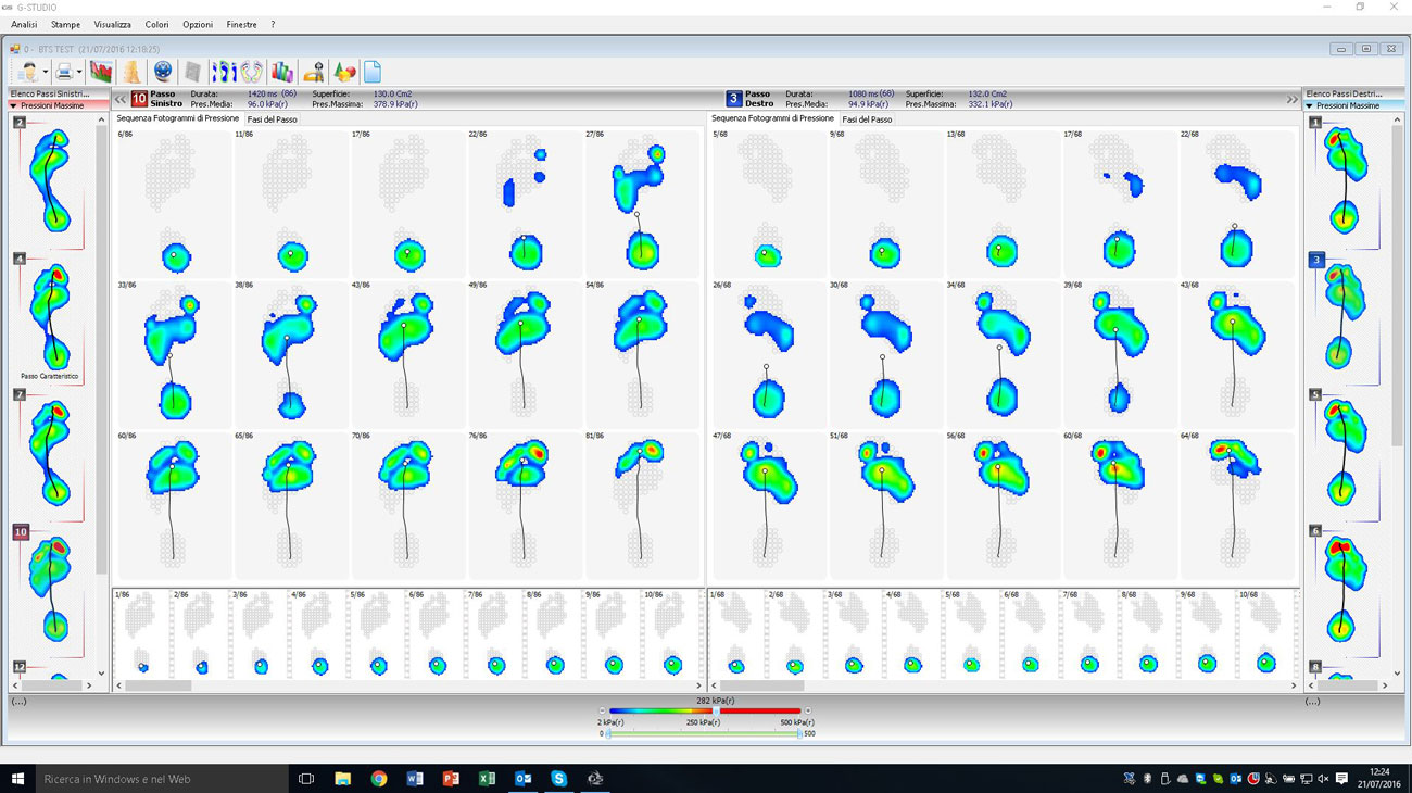 P-WALK report dinamico del software