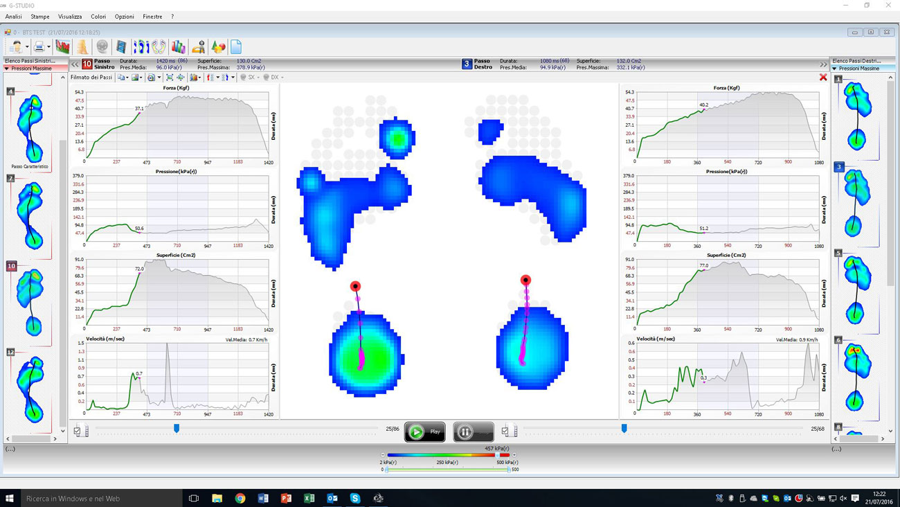 P-WALK Dynamic Report