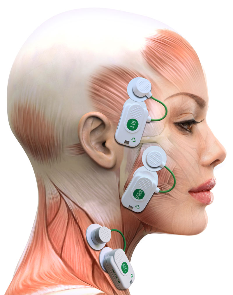 TMJOINT sonde e muscoli